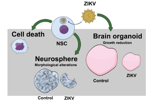 virus zika et malformation cérébrale